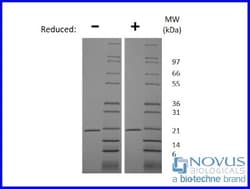 Novus Biologicals Recombinant Mouse TRANCE/TNFSF11/RANK L Animal-Free Protein 100 &mu;g | Buy Online | Novus Biologicals&trade; | Fisher Scientific